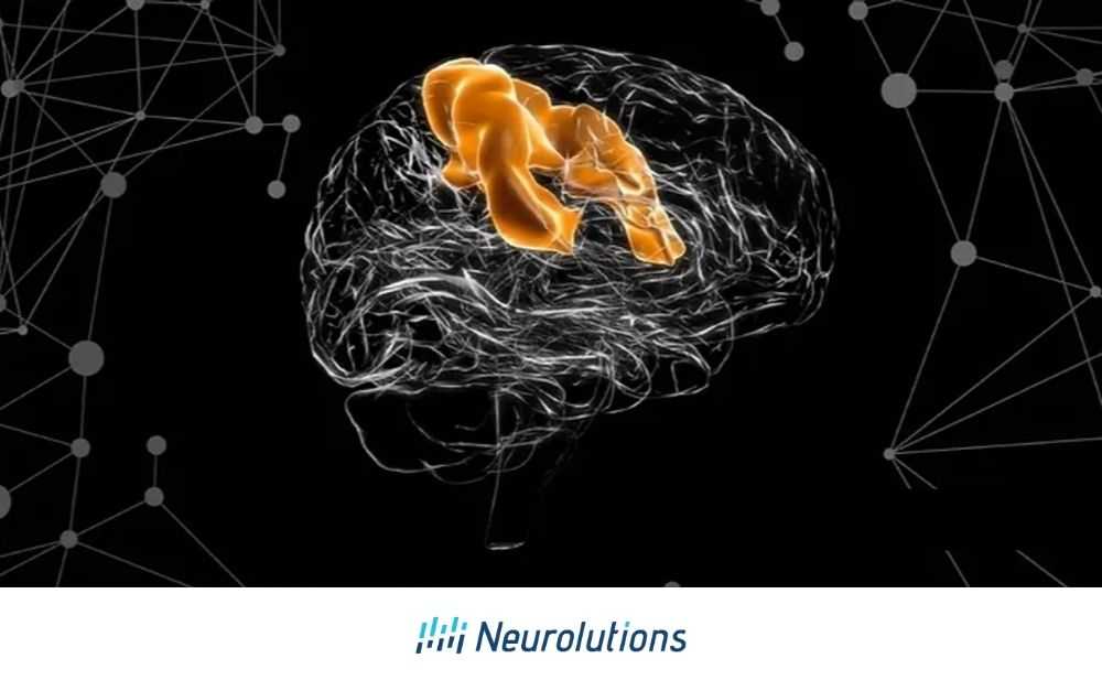 The Effects of Stroke on the Motor Cortex