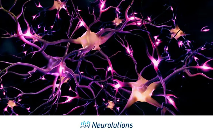 neuron firing