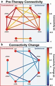 brain computer interface results from patients