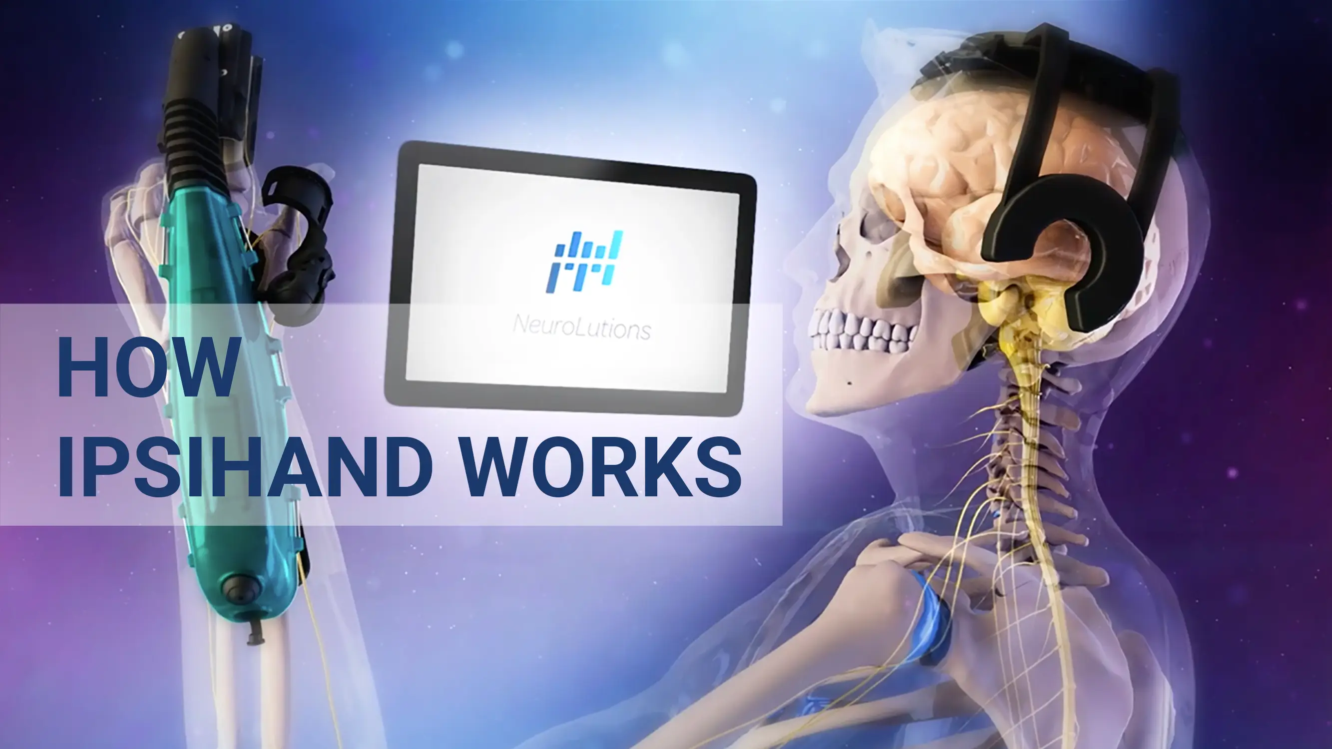 Neurolutions The Latest Breakthrough in Stroke Recovery