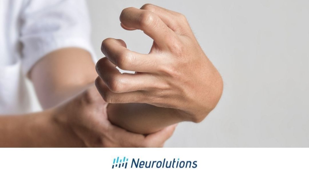 Introduction to Muscle Hypertonicity and Stroke