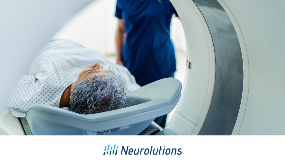 Understanding Thalamic Pain Syndrome