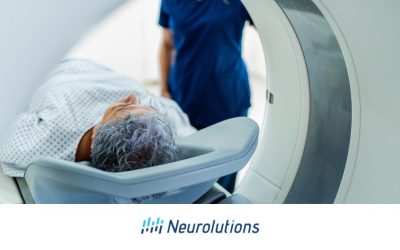 Understanding Thalamic Pain Syndrome